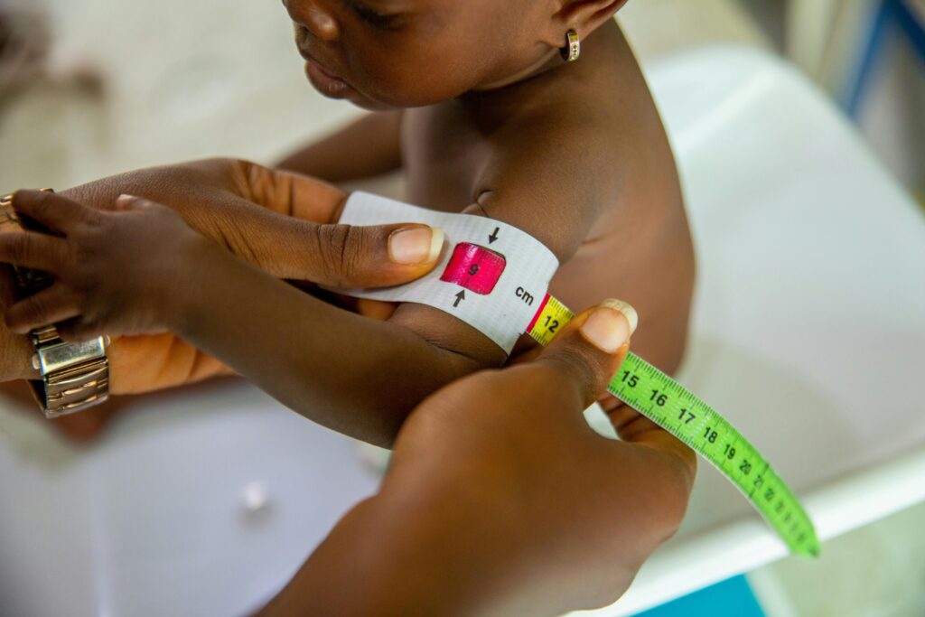 Home A healthcare professional measures a child's arm using MUAC tape for malnutrition assessment.
